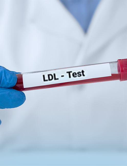 Lipid Profile  (LDL only)