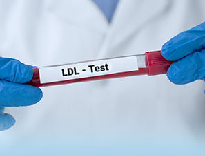 Lipid Profile  (LDL only)